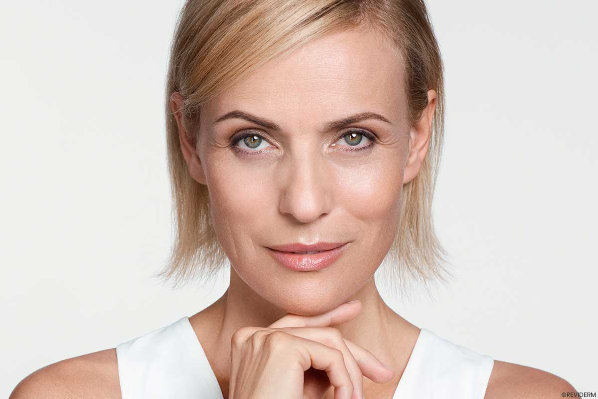 reviderm pca peeling